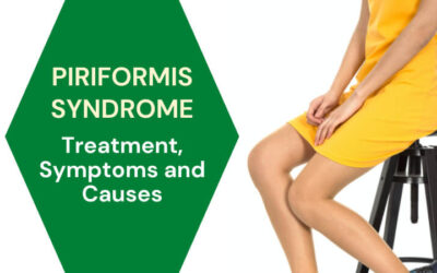 Piriformis Syndrome Treatment, Symptoms and Causes