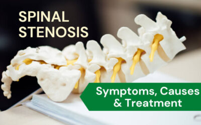 Spinal Stenosis: What is it, Symptoms, Causes & Treatment