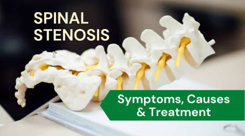 Spinal Stenosis: What Is It, Symptoms, Causes & Treatment 