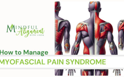 Myofascial Pain Syndrome and How to Manage It